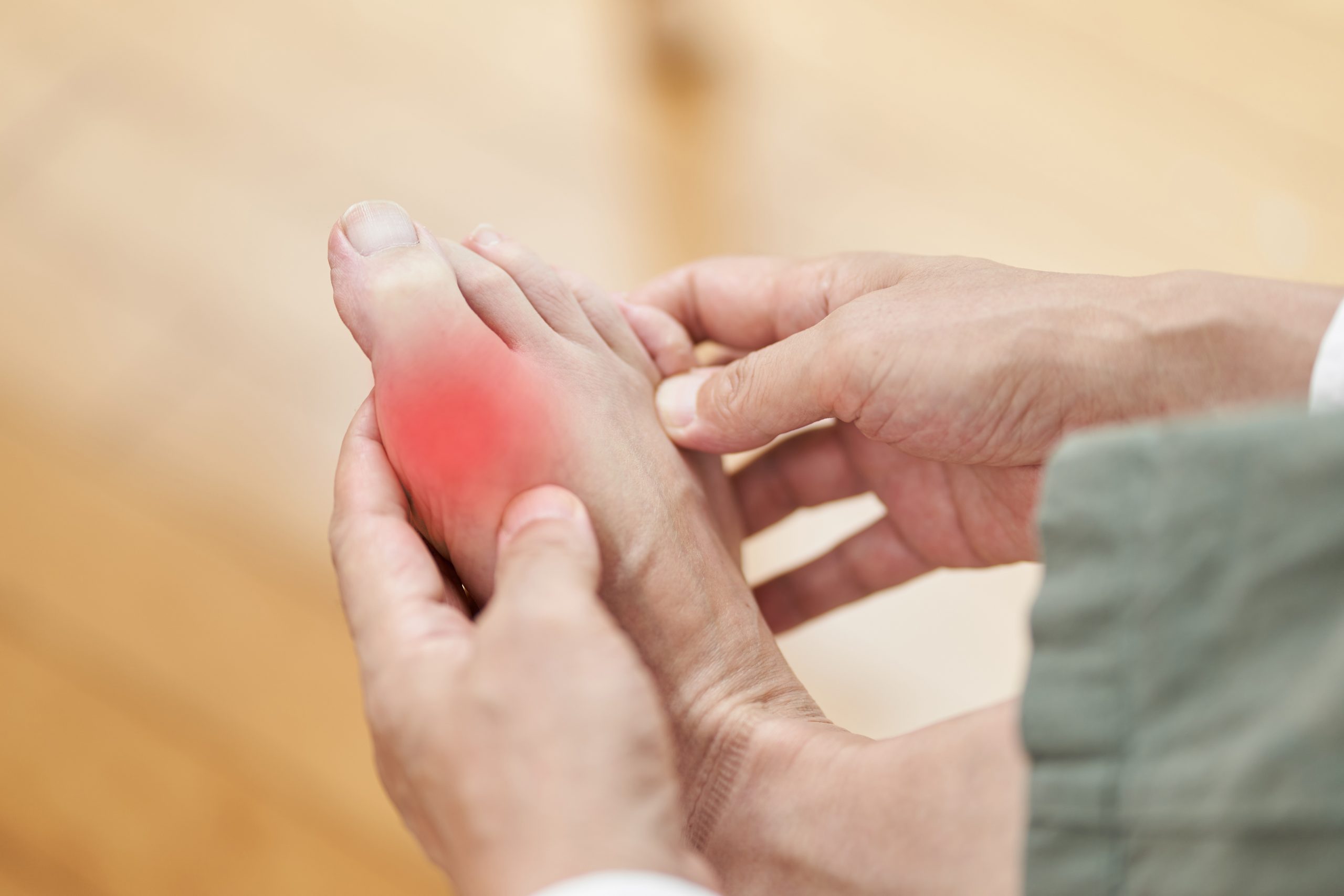 Is Gout treatable in a Natural way?